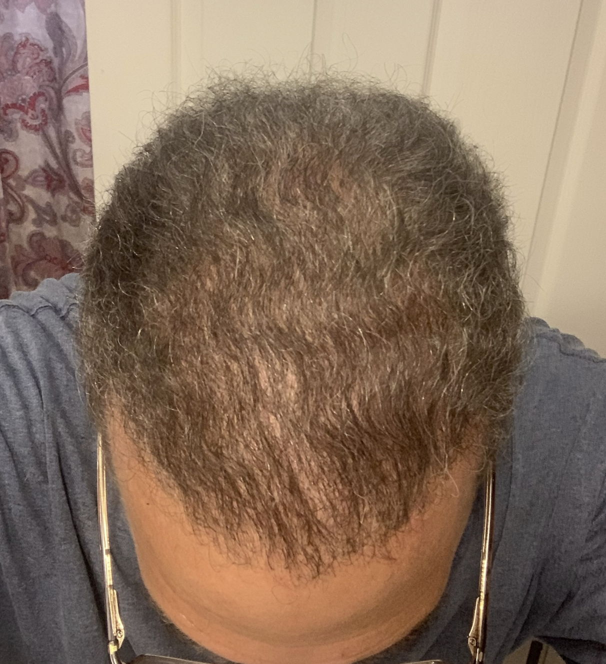 After